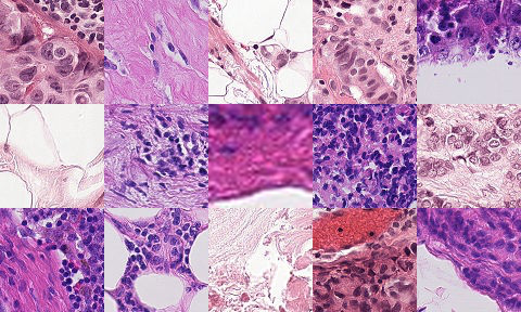 Medical Images